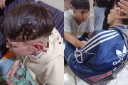 Dos menores fueron atacados con armas blancas en un cumpleaños